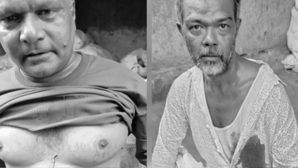 Extortion bid turns violent at Jamshedpur’s Sakchi market, three stabbed