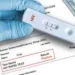 Jharkhand News: HIV status hidden, five MMCH Daltonganj staff undergo PEP
