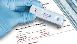 Jharkhand News: HIV status hidden, five MMCH Daltonganj staff undergo PEP